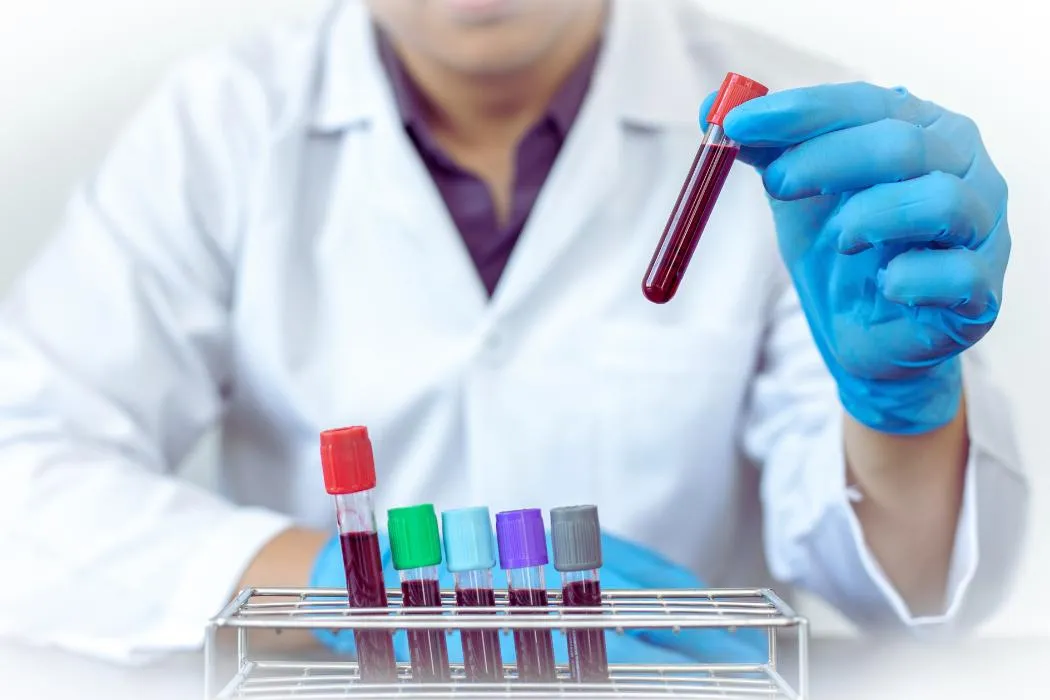 Врач-нарколог готовит инъекцию для кодирования Торпедо, Одесса